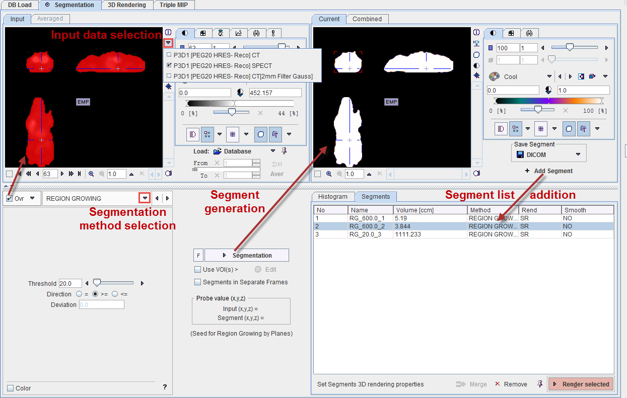 SegmentationPageDescription