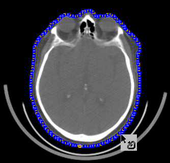 VOI Iso-Contour