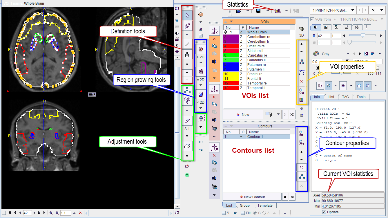 VOI Interface