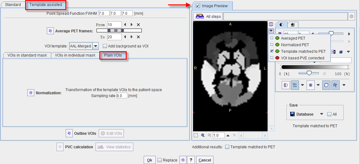 PVC using Template VOIs based on Plain VOIs