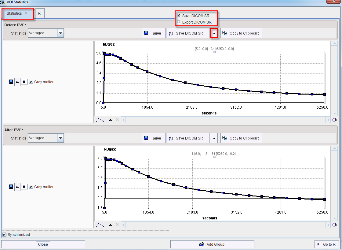 PVC_MRI_Statistics