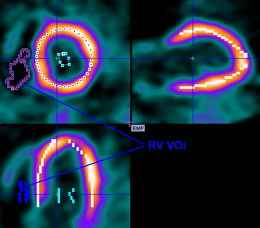 PCARD RV Isoconour