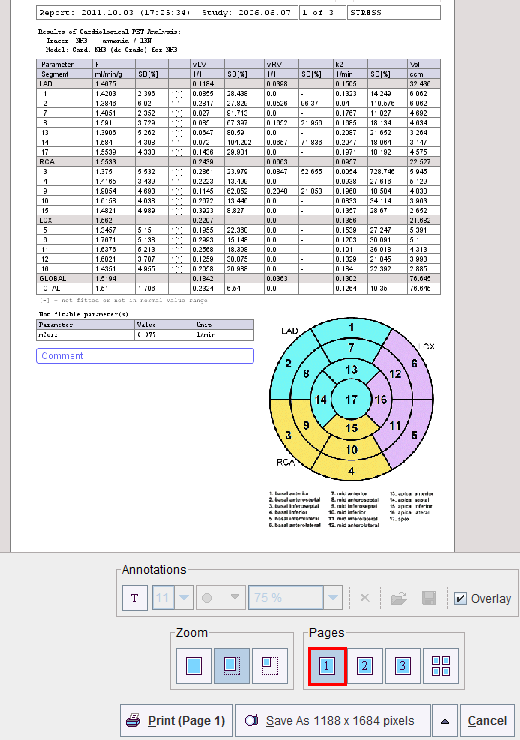 PCARD Main Report