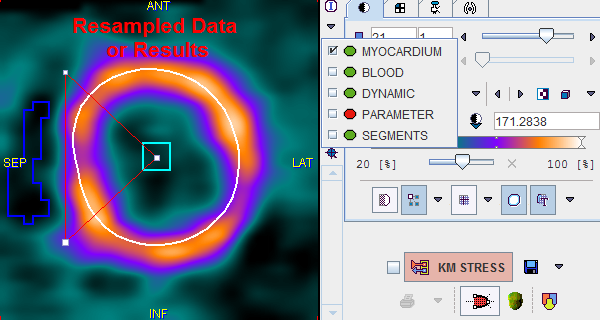 PCARD Result Data Selection