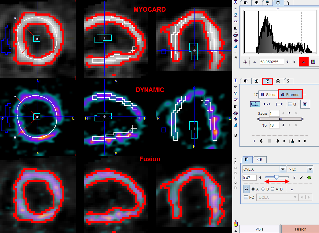 PCARD Data in Fusion