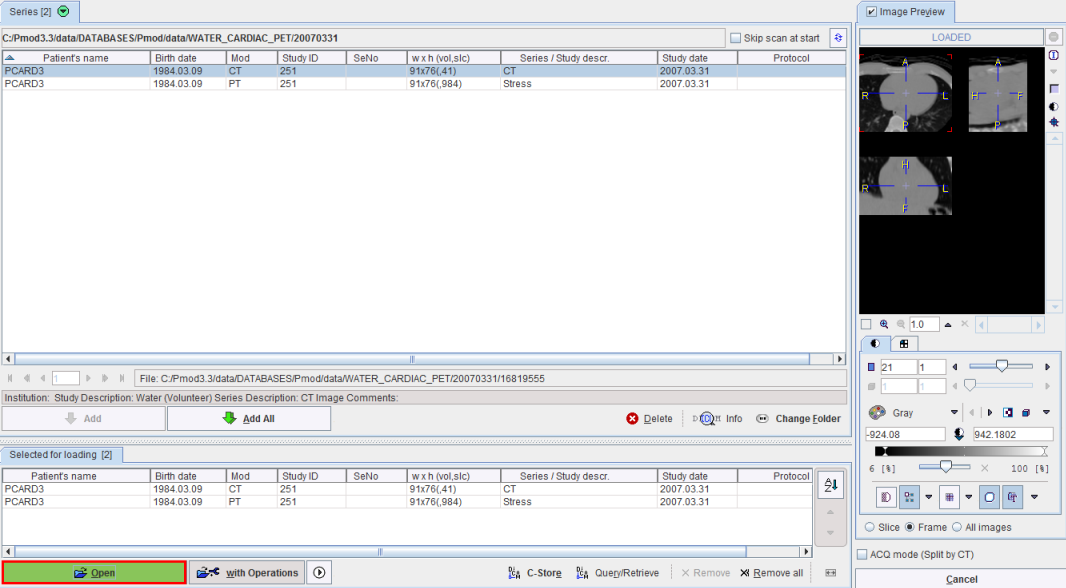 PCARD Load Transmission and Dynamic