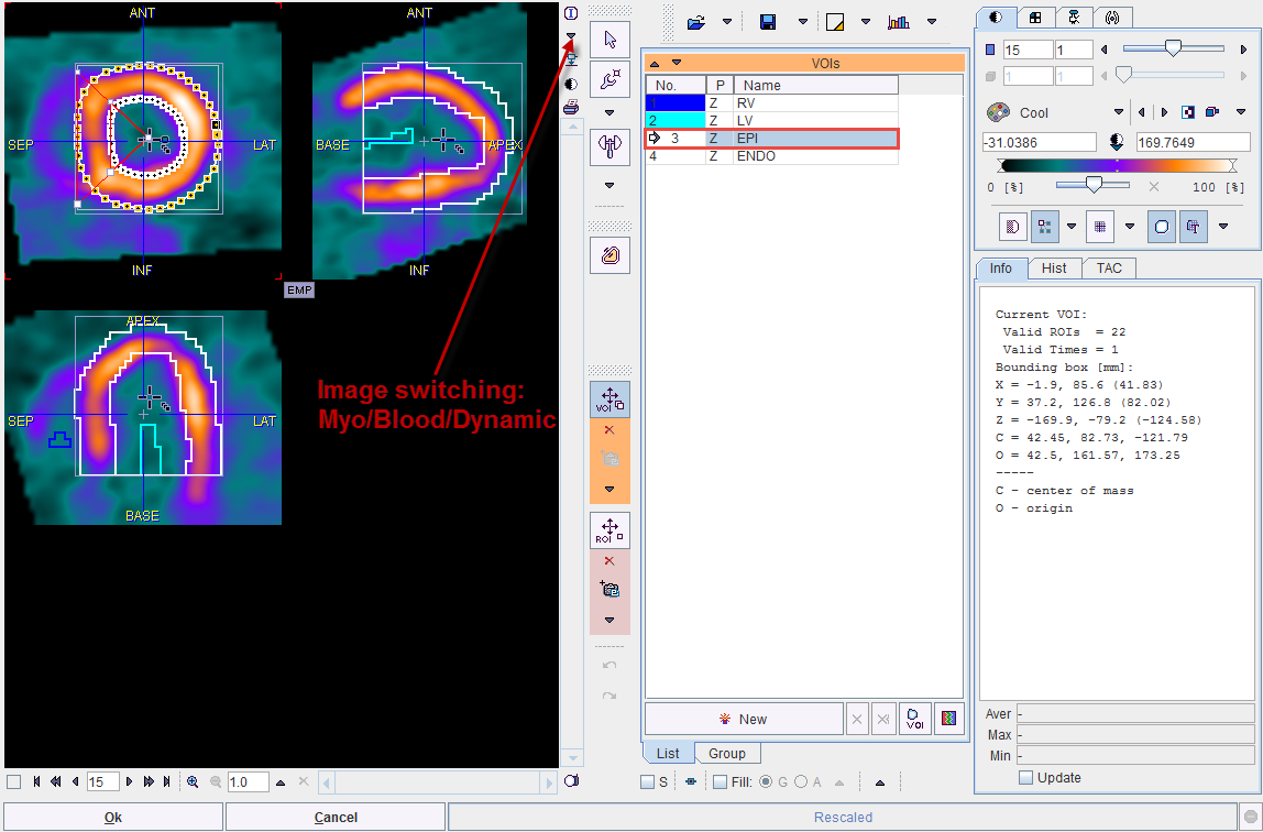 PCARD VOI Editing Dialog