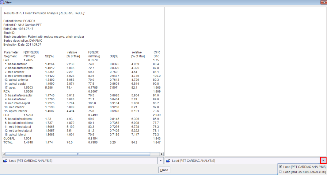 View Results-Comparison Window