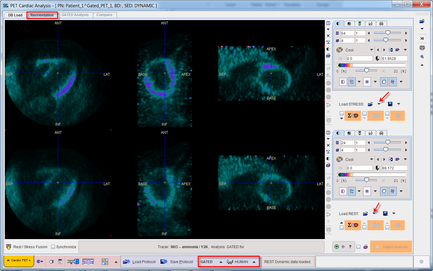 GatedAnalysisReorientationPage