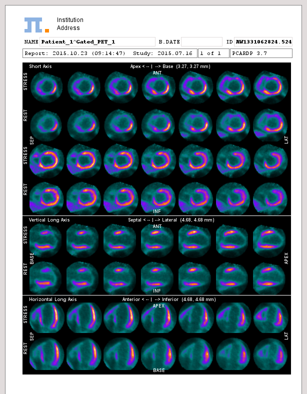 GatedCardiologicalReport