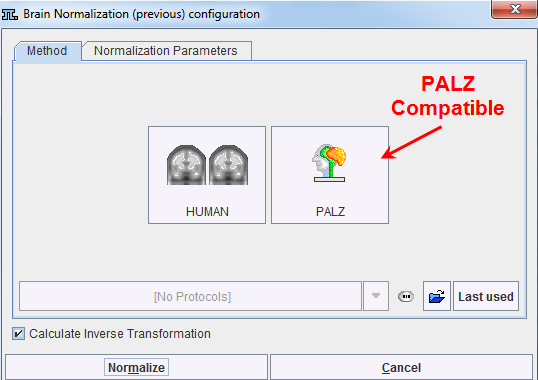 MatchingNormalizationDialog