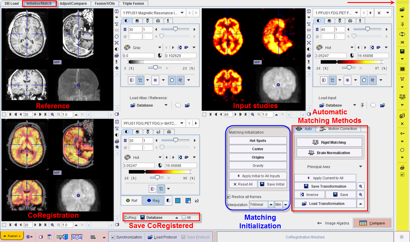 PFUS GUI1