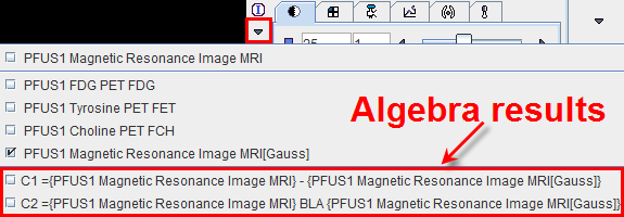 Algebra Result Selection