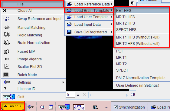 PFUS Load Brain Templates