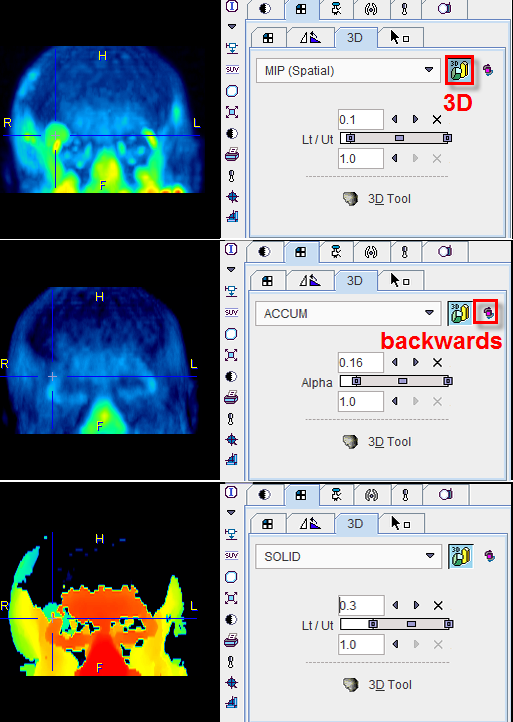 Volume Rendering Examples