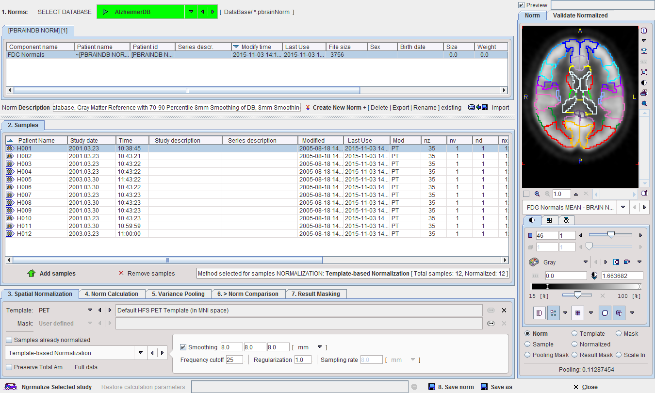 Brain DB Editor User Interface