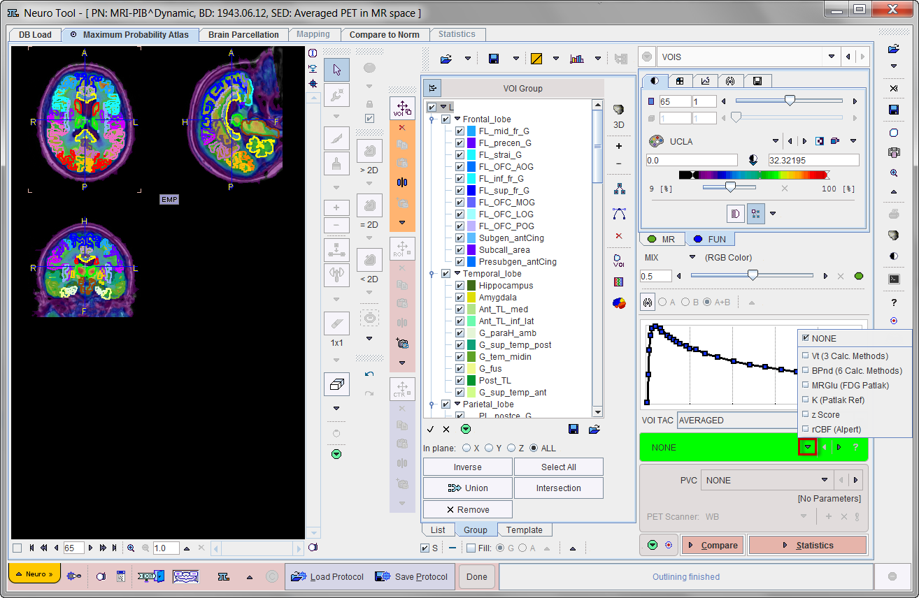 MappingModelSelection